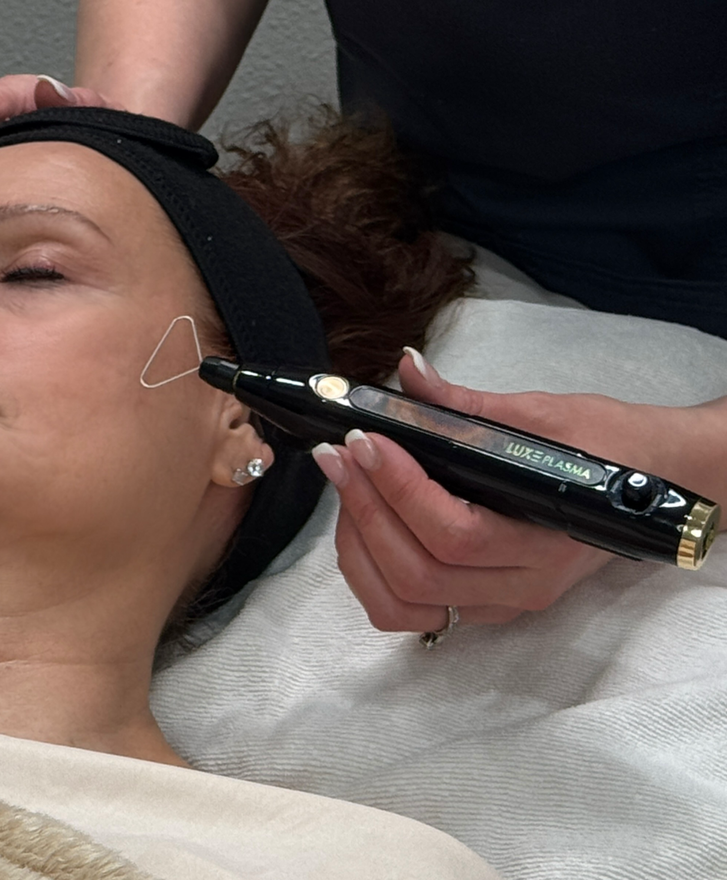 PlasmaChanneling™ treatment