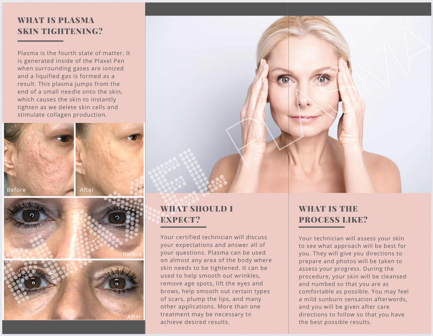 Client Informational Brochure