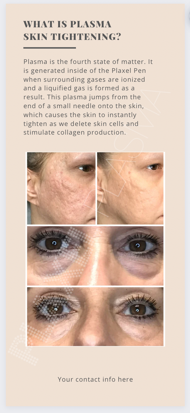 Client Informational Rack Card