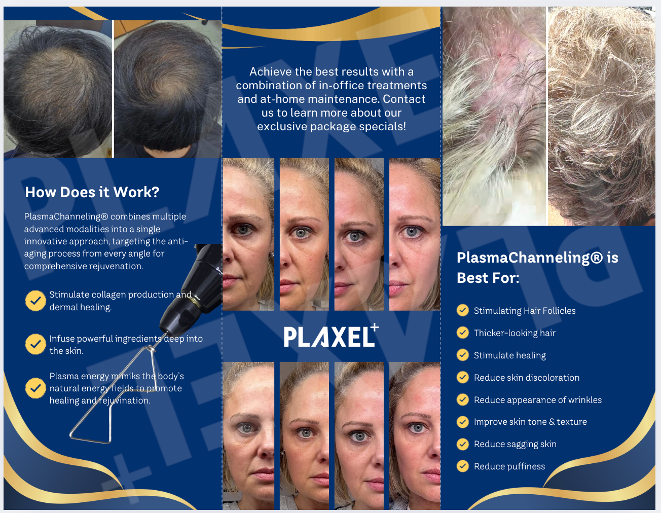 PlasmaChanneling Brochure PLAXEL+