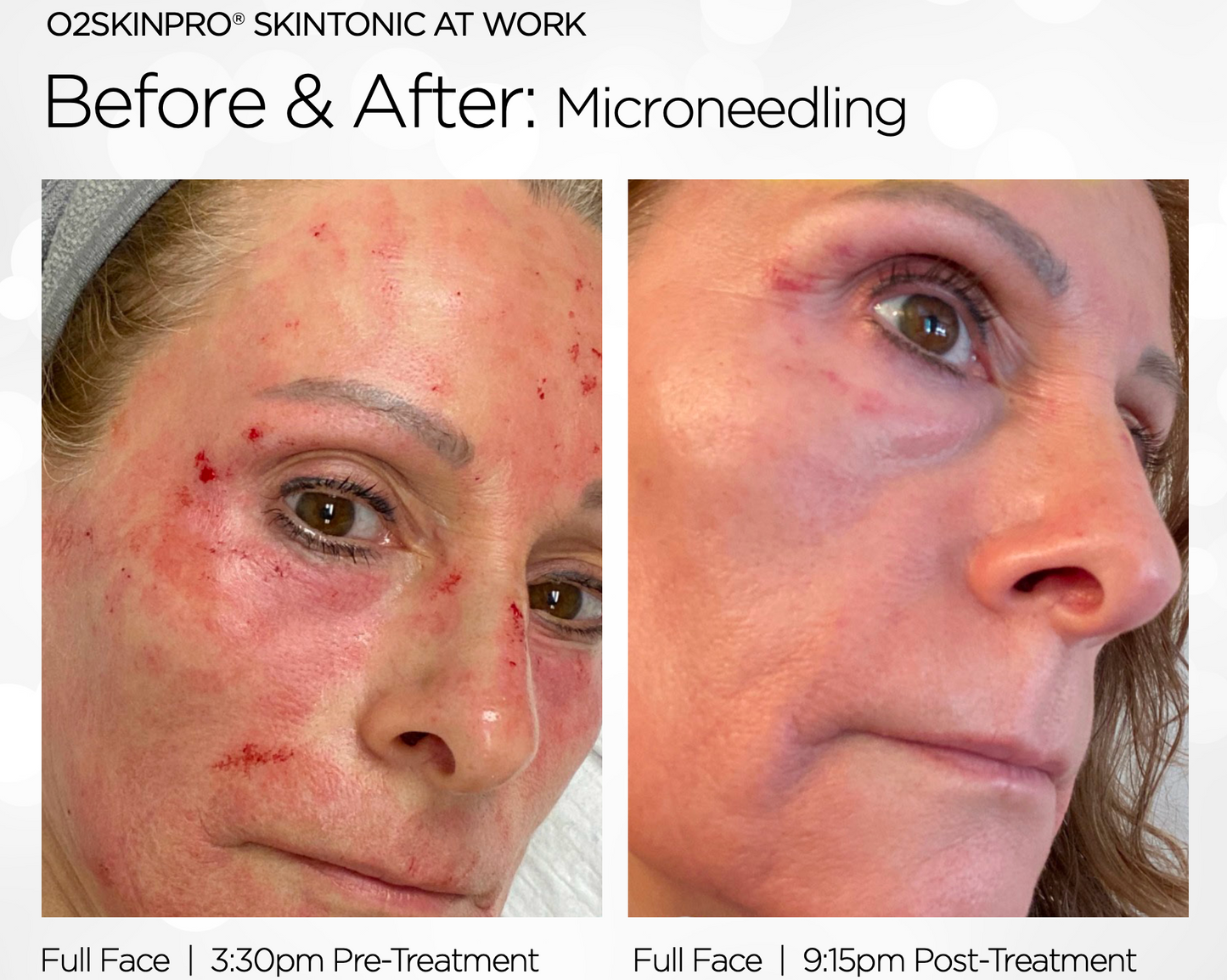 O2SkinPro Healing Skin Tonic Spray (2oz)