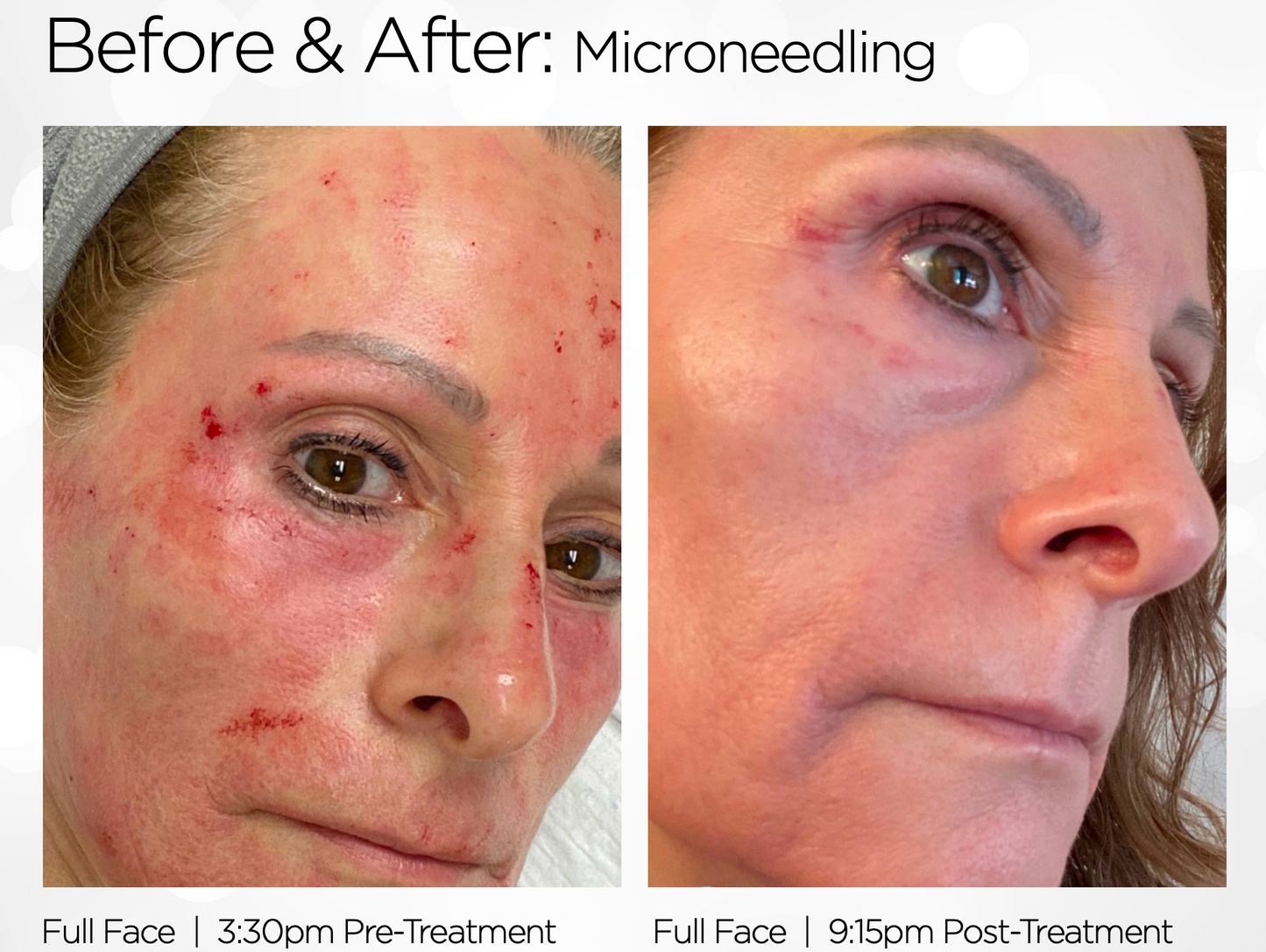 O2Revive MD™ Healing Spray (2oz)