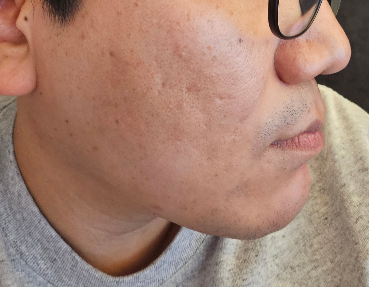 Blion:Cell The Ultimate Korean Skincare Bundle