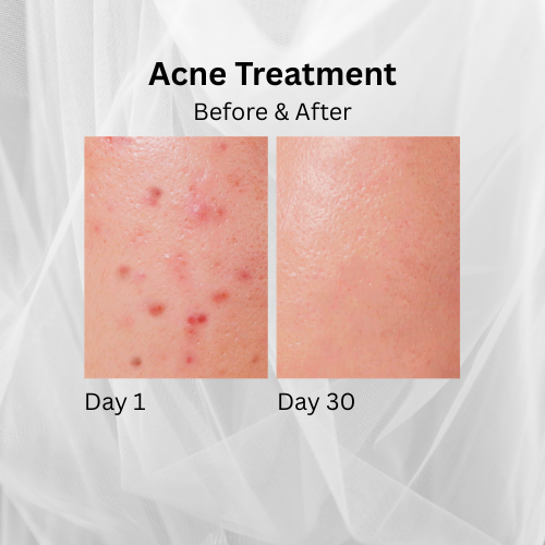 O2Revive MD™ Healing Spray (2oz)