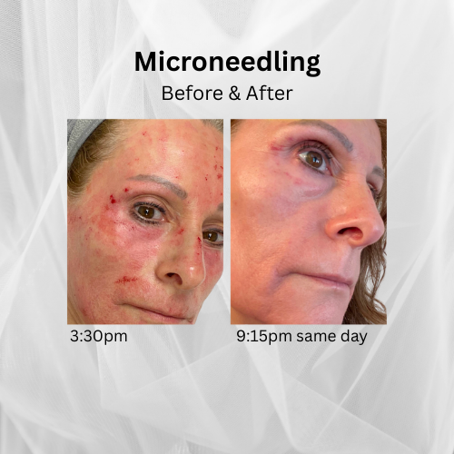 O2Revive MD™ Healing Spray (2oz)