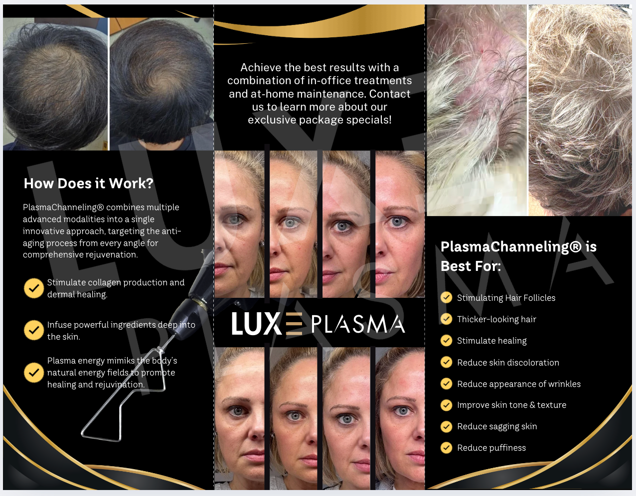 PlasmaChanneling Brochure LUXE Plasma