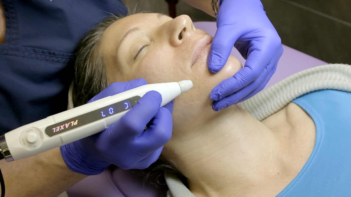 In-Person Plasma Pen Training